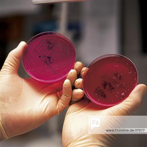 Nahaufnahme der Person Hände beobachten Bakterien Kultur