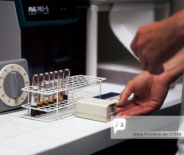 Doktors Hände Blut mit medizinischer Geräte im Labor testen