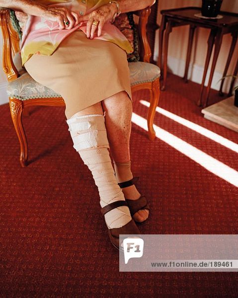 Ältere Frau mit bandagiertem Bein