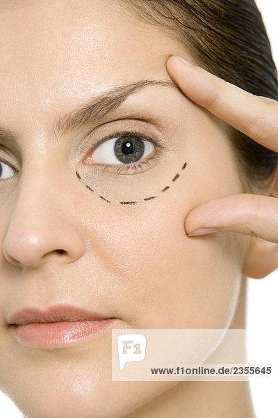 Frau mit plastischen Operationsmarkierungen unter einem Auge  berührendes Gesicht  Blick in die Kamera