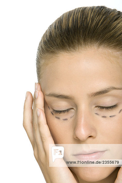 Frau mit plastischen Operationsmarkierungen unter den Augen  Gesicht haltend  Augen geschlossen