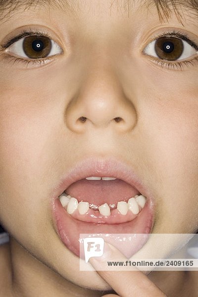 Ein Junge  der seine fehlenden Zähne zeigt.