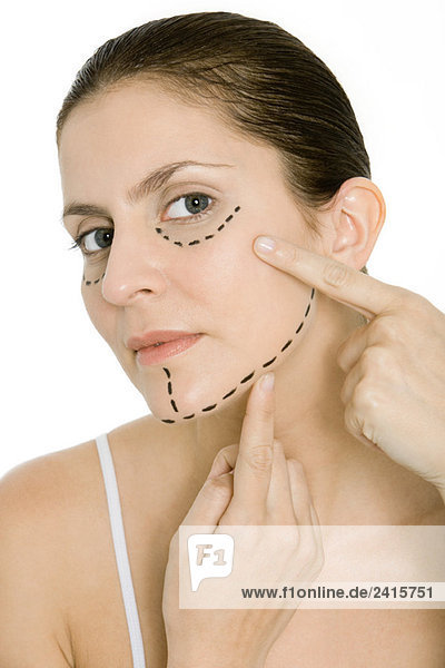 Woman pointing at plastic surgery markings on face  looking at camera