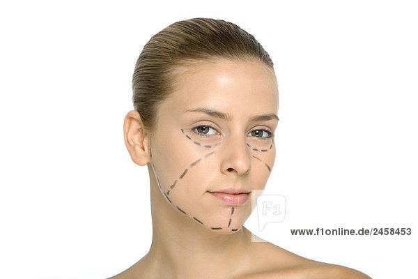 Junge Frau mit plastischen Operationsmarkierungen im Gesicht  Blick auf die Kamera