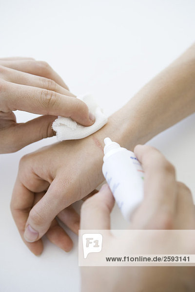 Arzt-Reinigungswunde an der Hand des Patienten  Schnittansicht