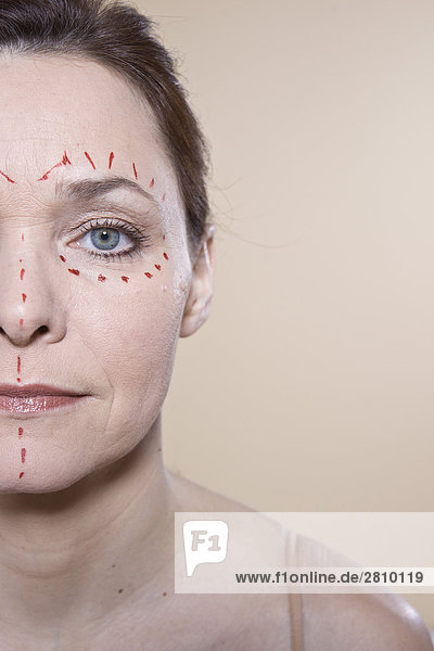 Markierungen auf Frau Gesicht vor plastische Chirurgie