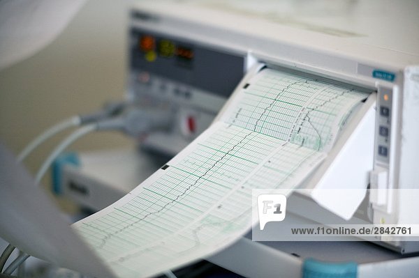 Herz-Monitor Maschine von 33 Jahre alte Frau Geburt im Krankenhaus  Heusenstamm  Québec  Kanada
