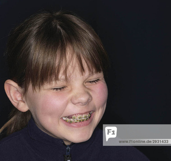 Mädchen lächelt  Zahnspange zeigt  Nahaufnahme