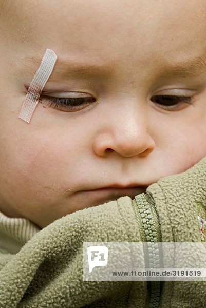 Ein kleiner Junge mit einem verwundeten Auge  Schweden.