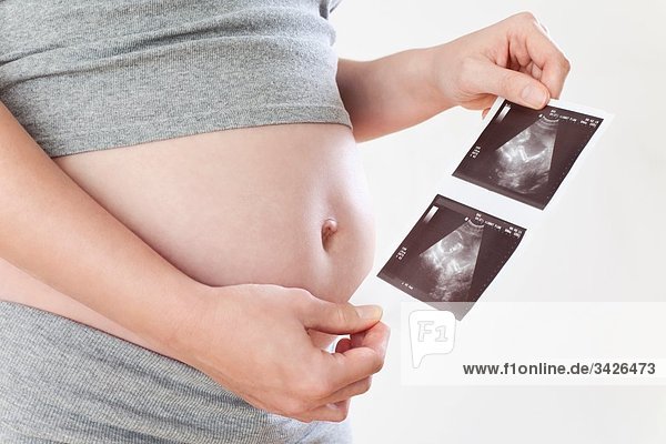 Schwangere mit Ultraschallbildern  Mittelteil