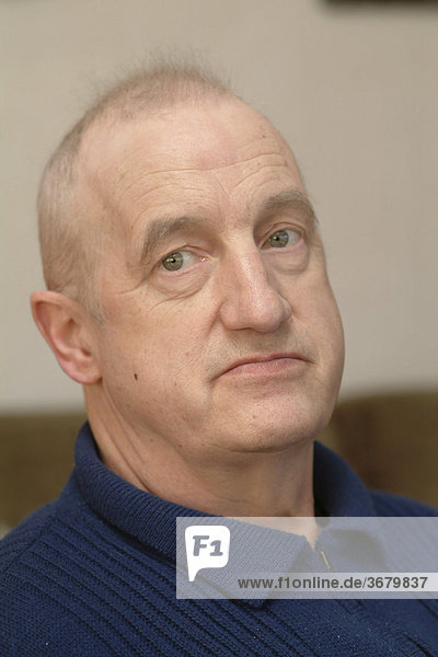 Mann mit haarausfall nach Chemotherapie