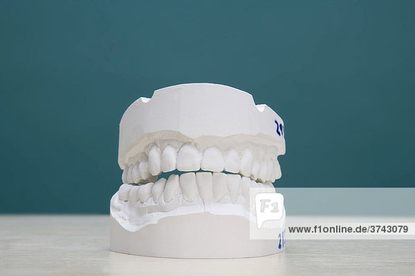 Plastercast of a set of teeth