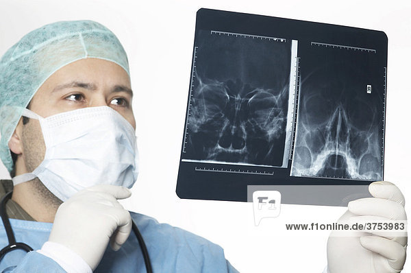 Arzt begutachtet Röntgenbild eines Schädels