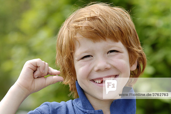Boy with a tooth gap space losing his baby teeth deciduous milk teeth
