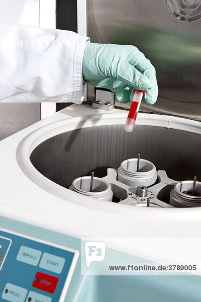 Ein Laborant  der ein Fläschchen mit Blut in eine Zentrifuge legt  Nahaufnahme der Hand.