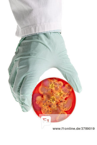 Ein Laborant hält eine Petrischale mit einer darin wachsenden Bakterienkultur  Nahaufnahme der Hand.