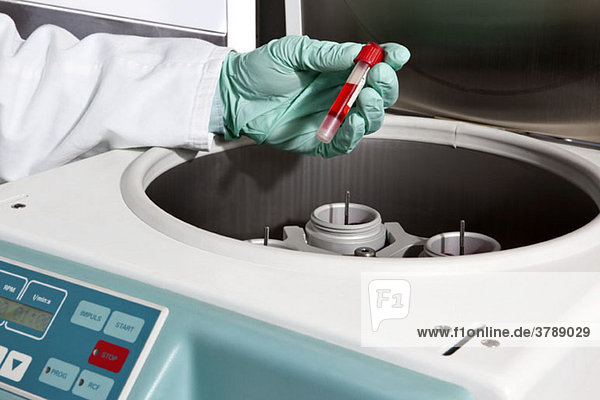 Ein Laborant  der ein Fläschchen mit Blut in eine Zentrifuge steckt  Nahaufnahme der Hände.