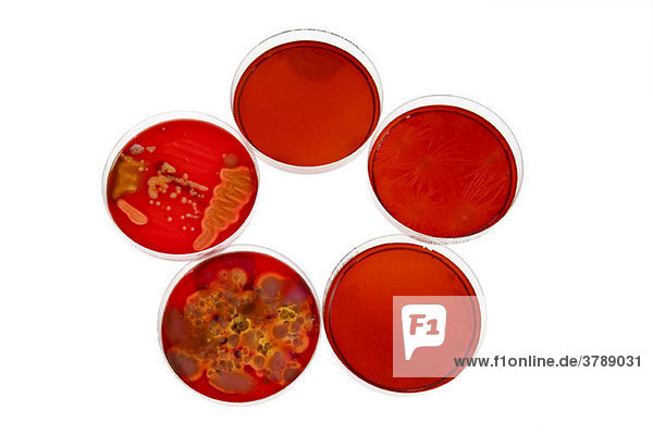 Petrischalen mit verschiedenen Stadien von Bakterienkulturen