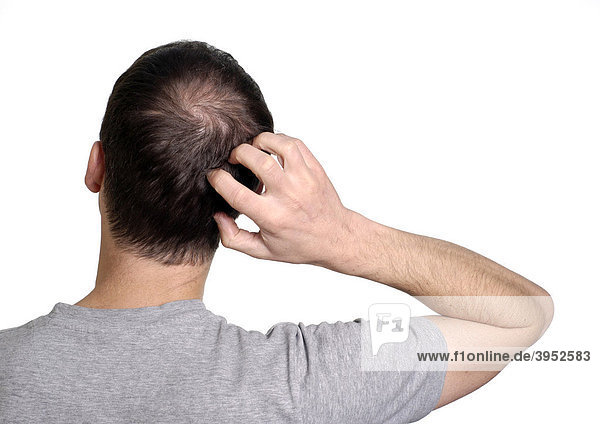 Man scratching the back of his head