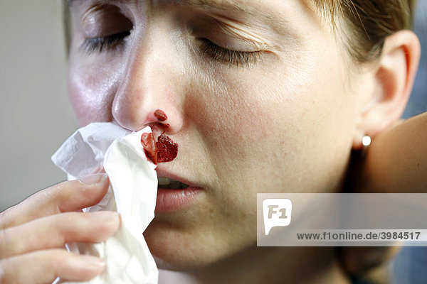Nose of a young woman bleeding