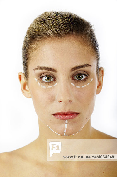 Junge Frau mit Markierungen im Gesicht für Schönheitsoperation