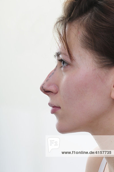 Portrait Frau vor Schönheitsoperation mit Zeichnung für Operation  Nase  Linien  Hakennase  Profil