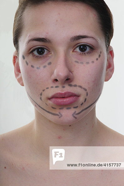 Portrait Frau vor Schönheitsoperation mit Zeichnung für Operation  Chirurgie  Linien  Akne  Pickel  Hautprobleme