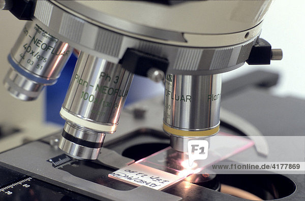 Mikroskopie von Gewebeschnitten zur Analyse von Krebszellen