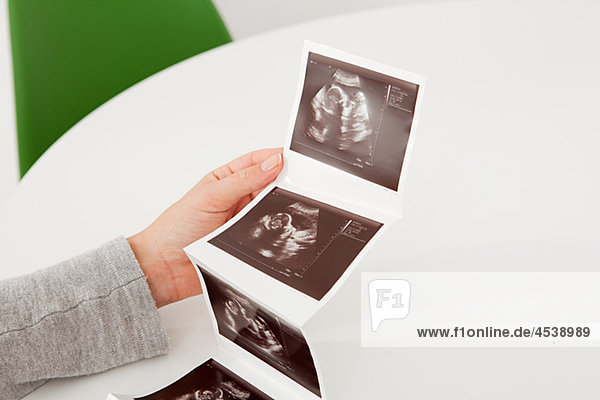 Woman holding baby scan