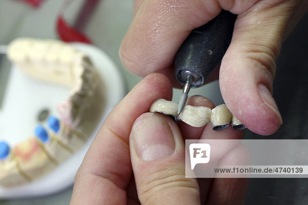 Zahntechnisches Labor  Herstellung von Zahnersatz durch einen Meisterbetrieb  Beschleifen  Separieren einer keramisch verblendeten Zahnbrücke