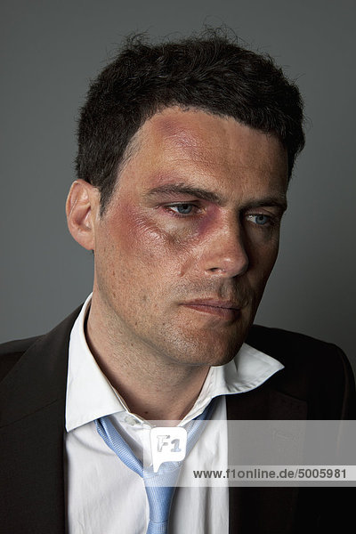 A defeated businessman with bruises