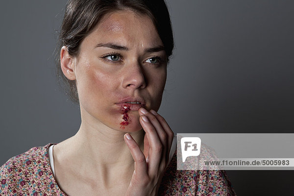 A woman with bruises and bloody lip mouth