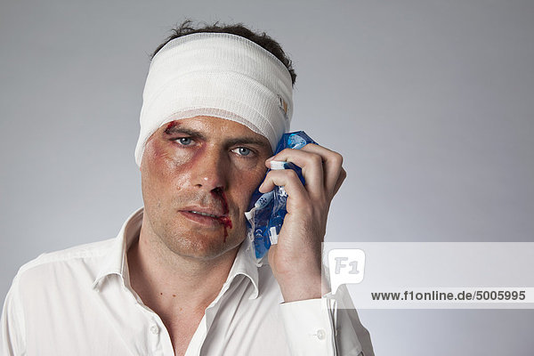 Ein Mann mit blauen Flecken und einem bandagierten Kopf  der einen Eisbeutel im Gesicht hält.