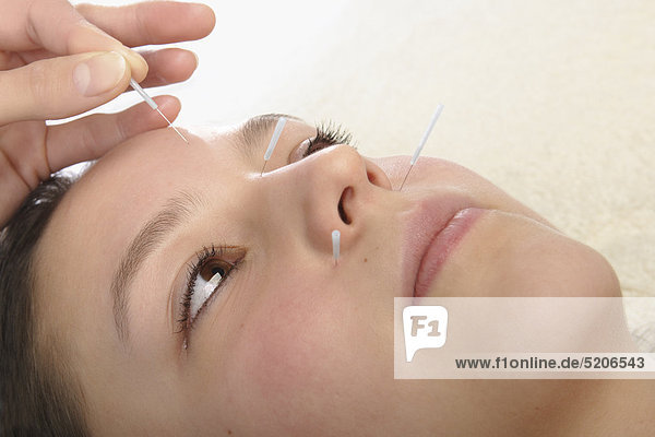 Akupunktur  Frau bekommt Nadeln im Gesicht gesetzt