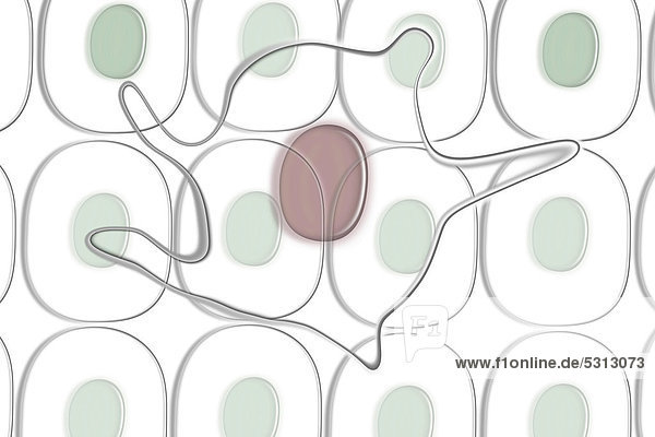 Illustration  Entstehung eines Tumors