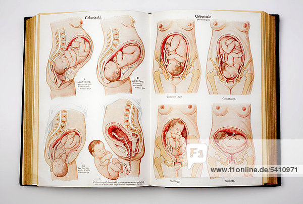 Geburtsakt Verschiedene Positionen Bei Der Geburt Eines Kindes Illustrationen Aus Dem Buch Dr F Konig S Ratgeber In Gesunden Und Kranken en 1928