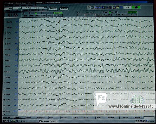 Aufzeichnung eines EEG in einer neurologischen Praxis