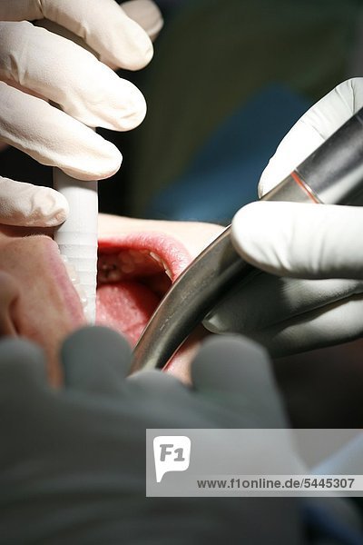 Zahnarztpraxis : Ein Patient wird von einem Zahnarzt und einer Zahnarzthelferin mit Bohrer und Absauger behandelt.