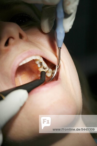 Zahnarztpraxis : ein Zahnarzt behandelt einen Patienten mit Bohrer und Mundspiegel
