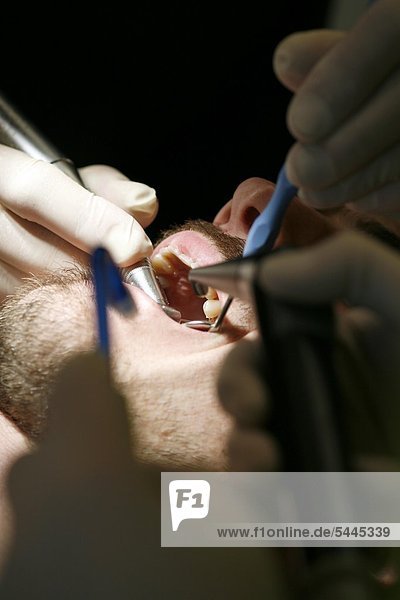 Zahnarztpraxis : Zahnarzt und Zahnarzthelferin behandeln einen Patienten mit Bohrer   Mundspiegel und Absauger