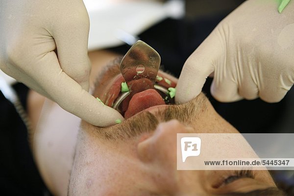 Zahnarztpraxis : Zahnarzt macht einen Abdruck des Unterkiefers bei Patienten