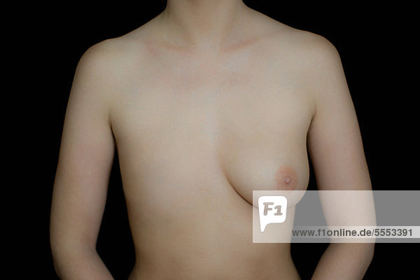 Nackter weiblicher Körper mit einer Brust vor schwarzem Hintergrund
