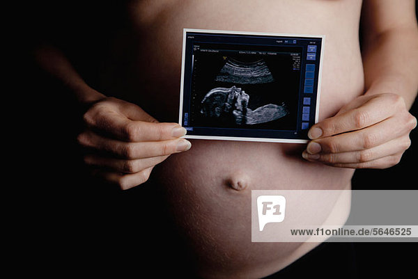 Eine schwangere Frau hält einen Ultraschall vor ihren nackten Bauch.