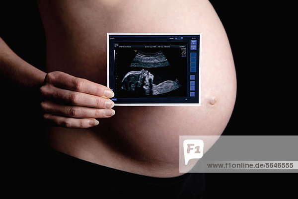 A pregnant woman holding an ultrasound in front of her naked belly