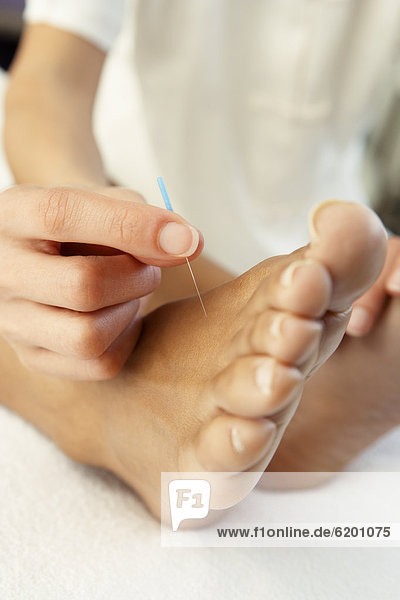 Close up of Acupuncture treatment