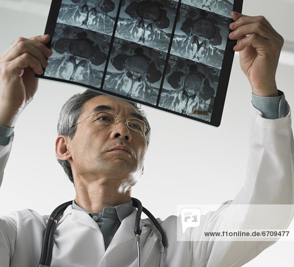 Männlichen Arzt Blick auf Röntgenbilder