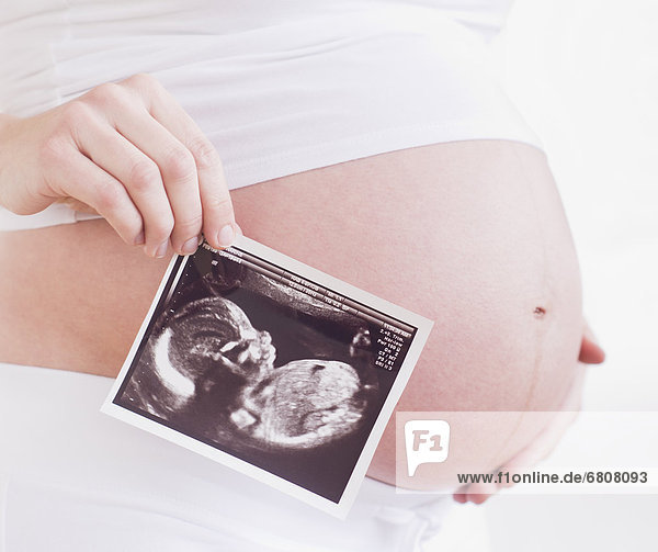 Frau  Schwangerschaft  scan