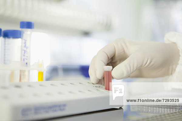 Germany  Bavaria  Munich  Scientist researching blood in laboratory