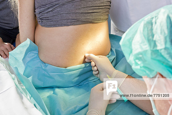 Während der Entbindung im Kreißsaal setzt der Anästhesist der Schwangeren eine PDA oder Periduralanästhesie