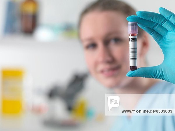 Techniker mit barcodierter Blutprobe im klinischen Labor